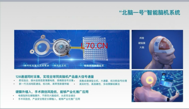 “北脑一号”脑机接口进入临床研究 助力高位截瘫患者康复